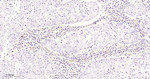 FAP Antibody in Immunohistochemistry (Paraffin) (IHC (P))
