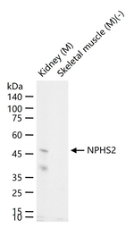 Podocin Antibody in Western Blot (WB)