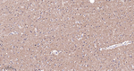 Phospho-Tau (Ser404) Antibody in Immunohistochemistry (Paraffin) (IHC (P))