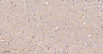 Phospho-Tau (Ser404) Antibody in Immunohistochemistry (Paraffin) (IHC (P))