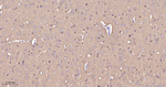 Phospho-Tau (Ser404) Antibody in Immunohistochemistry (Paraffin) (IHC (P))