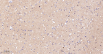 Phospho-Tau (Ser404) Antibody in Immunohistochemistry (Paraffin) (IHC (P))