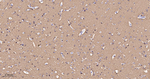Phospho-Tau (Ser404) Antibody in Immunohistochemistry (Paraffin) (IHC (P))