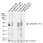 Phospho-Tau (Ser404) Antibody in Western Blot (WB)