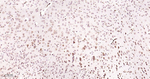 GSK3B Antibody in Immunohistochemistry (Paraffin) (IHC (P))