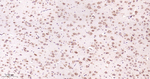 GSK3B Antibody in Immunohistochemistry (Paraffin) (IHC (P))