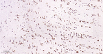 GSK3B Antibody in Immunohistochemistry (Paraffin) (IHC (P))