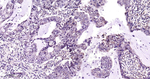 GSK3B Antibody in Immunohistochemistry (Paraffin) (IHC (P))