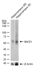 BACE1 Recombinant Rabbit Monoclonal Antibody (13F6)