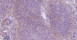 p38 MAPK Antibody in Immunohistochemistry (Paraffin) (IHC (P))