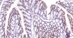 p38 MAPK Antibody in Immunohistochemistry (Paraffin) (IHC (P))