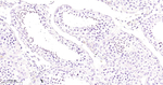 MBD1 Recombinant Rabbit Monoclonal Antibody (18A16)