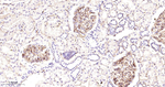 VEGF Receptor 2 Antibody in Immunohistochemistry (Paraffin) (IHC (P))
