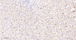 VEGF Receptor 2 Antibody in Immunohistochemistry (Paraffin) (IHC (P))