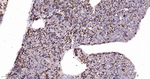 PIK3R4 Antibody in Immunohistochemistry (Paraffin) (IHC (P))