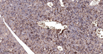 PIK3R4 Antibody in Immunohistochemistry (Paraffin) (IHC (P))