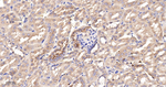 PIK3R4 Recombinant Rabbit Monoclonal Antibody (3G19)