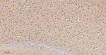 GOT1 Antibody in Immunohistochemistry (Paraffin) (IHC (P))
