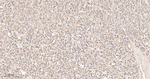 GOT1 Antibody in Immunohistochemistry (Paraffin) (IHC (P))