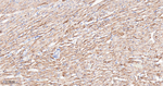 GOT1 Antibody in Immunohistochemistry (Paraffin) (IHC (P))