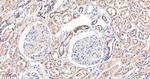 GOT1 Antibody in Immunohistochemistry (Paraffin) (IHC (P))