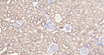 GOT1 Antibody in Immunohistochemistry (Paraffin) (IHC (P))