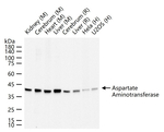 GOT1 Antibody in Western Blot (WB)