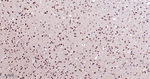 Phospho-mTOR (Ser2481) Antibody in Immunohistochemistry (Paraffin) (IHC (P))