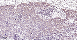 Phospho-mTOR (Ser2481) Antibody in Immunohistochemistry (Paraffin) (IHC (P))