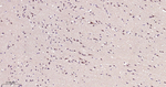 Phospho-mTOR (Ser2481) Antibody in Immunohistochemistry (Paraffin) (IHC (P))