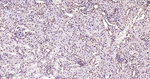 Phospho-mTOR (Ser2481) Antibody in Immunohistochemistry (Paraffin) (IHC (P))