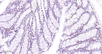 STAT5 alpha/beta Antibody in Immunohistochemistry (Paraffin) (IHC (P))