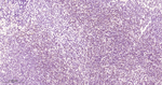 STAT5 alpha/beta Antibody in Immunohistochemistry (Paraffin) (IHC (P))