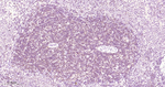 STAT5 alpha/beta Antibody in Immunohistochemistry (Paraffin) (IHC (P))