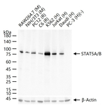 STAT5 alpha/beta Antibody in Western Blot (WB)