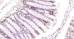 Ferritin Antibody in Immunohistochemistry (Paraffin) (IHC (P))