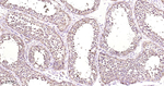 Ferritin Antibody in Immunohistochemistry (Paraffin) (IHC (P))