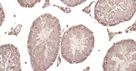 Ferritin Antibody in Immunohistochemistry (Paraffin) (IHC (P))