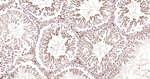 Ferritin Antibody in Immunohistochemistry (Paraffin) (IHC (P))