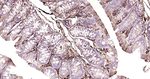 Ferritin Antibody in Immunohistochemistry (Paraffin) (IHC (P))