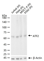 ATF2 Antibody in Western Blot (WB)