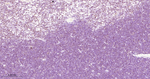 RUNX1/RUNX2/RUNX3 Antibody in Immunohistochemistry (Paraffin) (IHC (P))