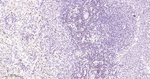 RUNX1/RUNX2/RUNX3 Antibody in Immunohistochemistry (Paraffin) (IHC (P))