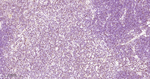 RUNX1/RUNX2/RUNX3 Antibody in Immunohistochemistry (Paraffin) (IHC (P))