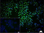 B-Raf Recombinant Rabbit Monoclonal Antibody (4F3)