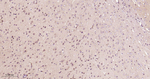 B-Raf Antibody in Immunohistochemistry (Paraffin) (IHC (P))