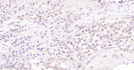 B-Raf Antibody in Immunohistochemistry (Paraffin) (IHC (P))