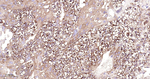 B-Raf Antibody in Immunohistochemistry (Paraffin) (IHC (P))