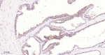 B-Raf Antibody in Immunohistochemistry (Paraffin) (IHC (P))