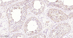 B-Raf Antibody in Immunohistochemistry (Paraffin) (IHC (P))